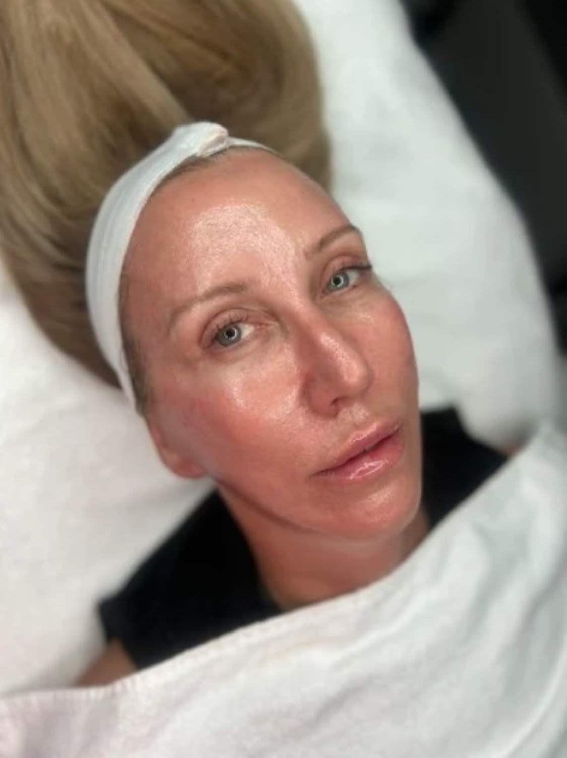 SKNRY Laser & Skin Aesthetics: Read Reviews and Book Classes on