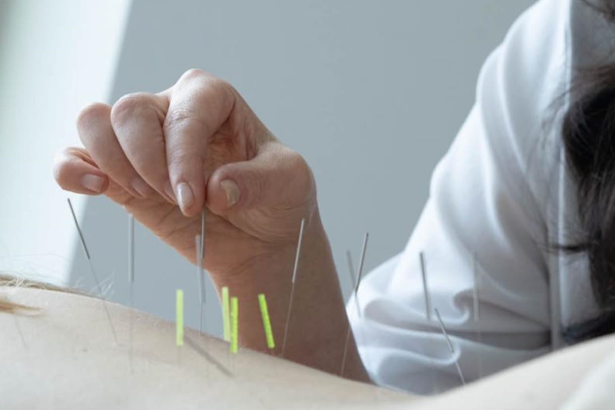 Pulse Acupuncture Brooklyn Read Reviews and Book Classes on ClassPass