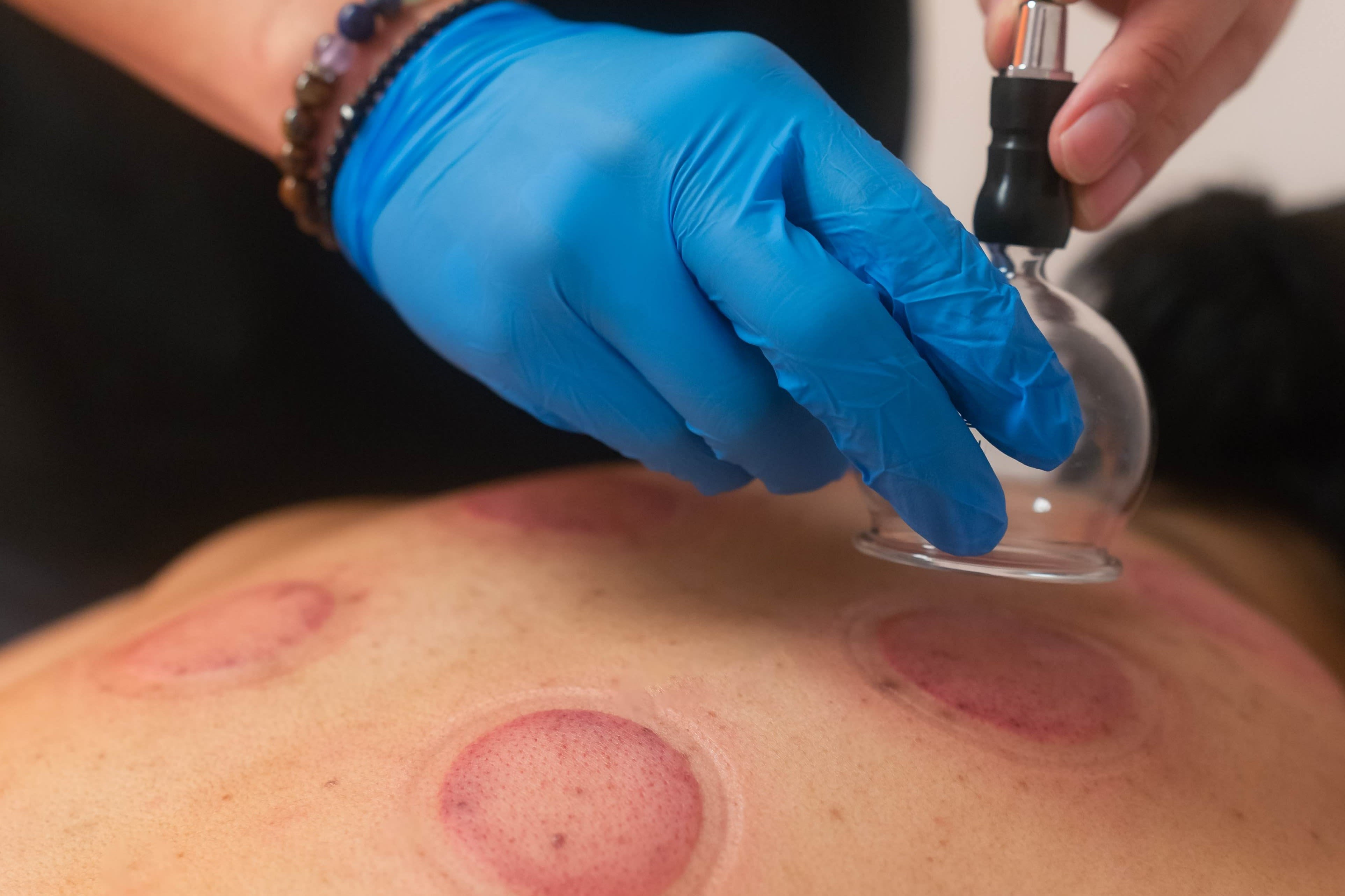 The Cupping Box: Read Reviews and Book Classes on ClassPass