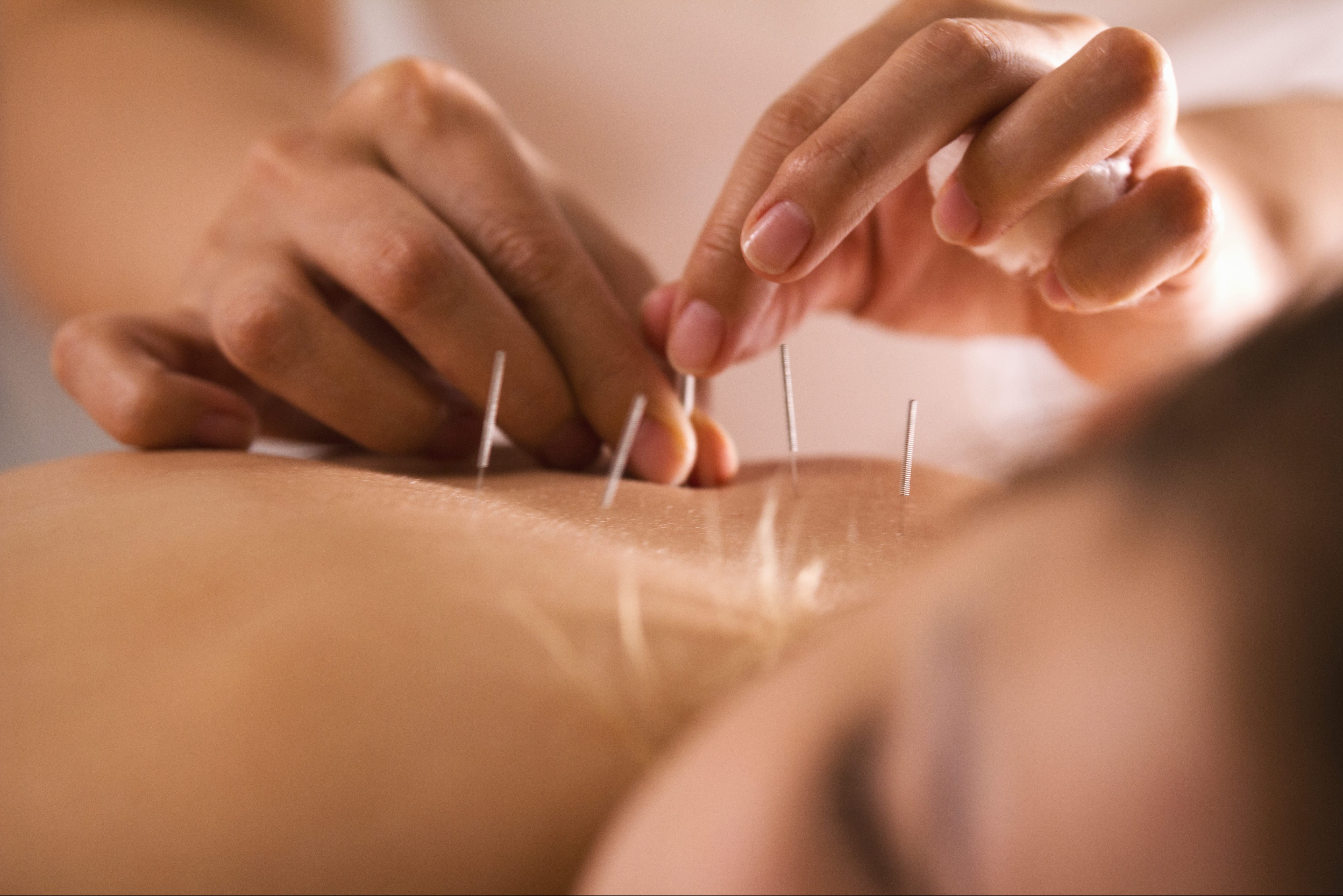 MIDTOWN ACUPUNCTURE AND PHYSICAL THERAPY: Read Reviews and Book Classes on  ClassPass