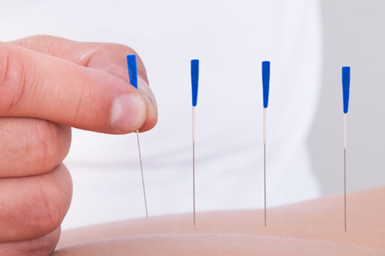 David Li Acupuncture Read Reviews and Book Classes on ClassPass