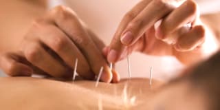 Acupuncture with Electro-Stimulation in Santa Monica/Los Angeles